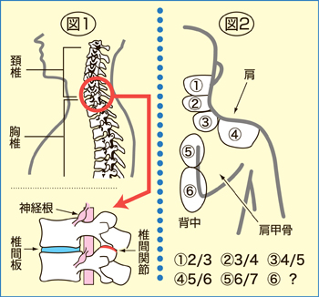 の 肩 首 から 痛み にかけて 首・肩・背中が一気に軽くなる「魔法のストレッチ」